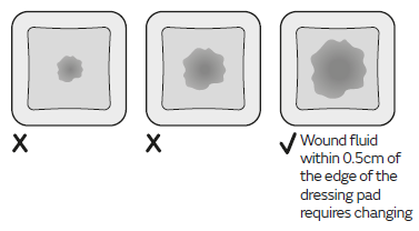 allevyn-gentle-border-when-to-replace